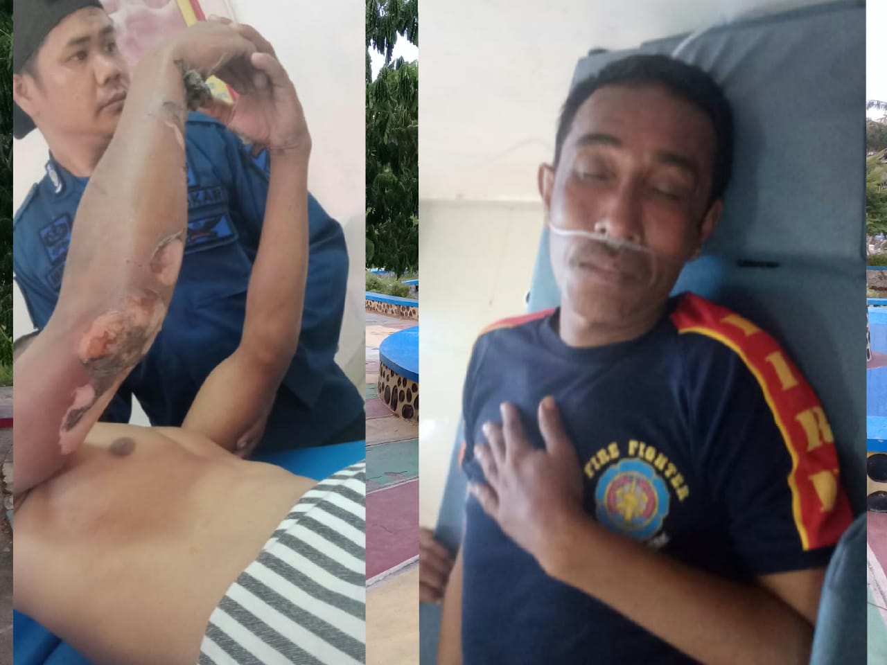 1 Petugas Pemadam Kebakaran Asal Bantaeng Alami Luka Bakar Saat Padamkan Api di Tamalatea Jeneponto