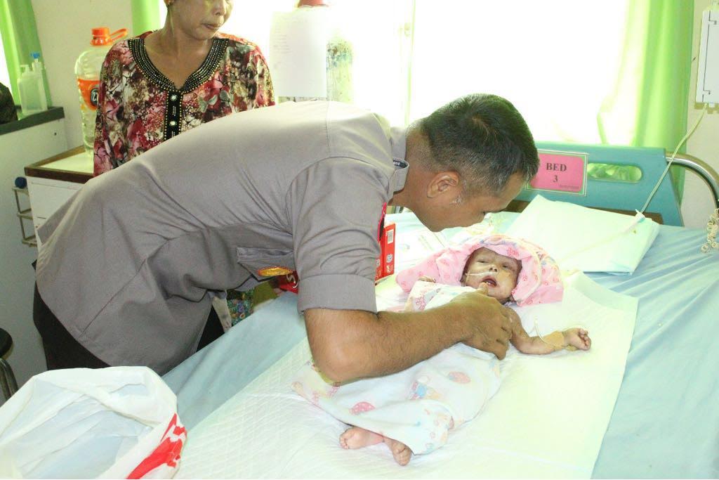 Kapolres Gowa Besuk Bayi Bersisik di RSUD Syekh Yusuf