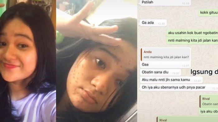 viral-nomor-whatsapp-wanita-diblokir-gebetan-gegara-wajah-jerawatan.jpg