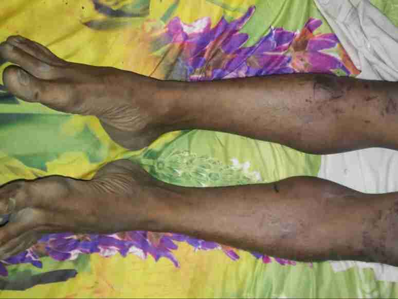 Dijemput Pria Cepak Bersenjata, Ali Pulang Jadi Mayat, Yonif 8 Marinir Sudah Datangi Rumah Korban