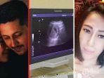 Kolase-Dewi-Sanca-dan-hasil-USG-kehamilannya-Dewi-Sanca-hamil-diluar-nikah.jpg