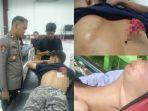 Kolase-korban-perang-antar-pemuda-1.jpg