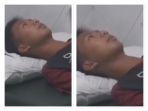 Kolase-santri-bernama-EAR-16-diduga-dibakar-teman.jpg