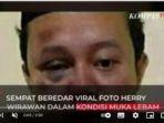 dalam-foto-yang-beredar-tampak-wajah-herry-pada-bagian-mata-sebelah.jpg