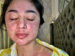 dewi-perssik-covid.jpg