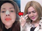 dulu-barbie-kumalasari-ngaku-habiskan-rp-4-m-biar-cantik-kini-hidungnya-jadi-sorotan-bisa-jebol.jpg
