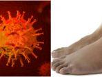 gejala-baru-virus-corona-atau-covid-19-ada-di-kaki-1-2742020.jpg