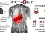kenali-gejala-penyebab-dan-penularan-hepatitis-a-penyakit-yang-diidap-80-siswa-smpn-20-depok.jpg