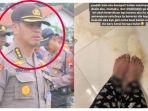 kombes-rachmat-widodo-alami-hal-mengerikan-usai-diduga-aniaya-anak-dan-istri-gegara-orang-ketiga.jpg
