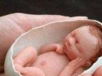 masih-ingat-amelia-taylor-saat-lahir-jadi-bayi-terkecil-di-dunia-begini-kondisinya-kini.jpg