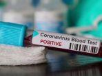 mengapa-orang-dengan-golongan-darah-o-lebih-tahan-virus-corona-dan-golongan-darah-a-paling-rentan.jpg