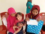 operasi-bibir-sumbing-gratis-polda-sulbar.jpg