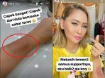 penyebab-tangan-inul-daratista-lebam-akhirnya-terungkap-istri-adam-suseno-minta-maaf-maafin-inul.jpg