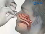 seorang-anak-di-arab-saudi-meninggal-dunia-setelah-alat-swab-patah-dalam-hidung.jpg