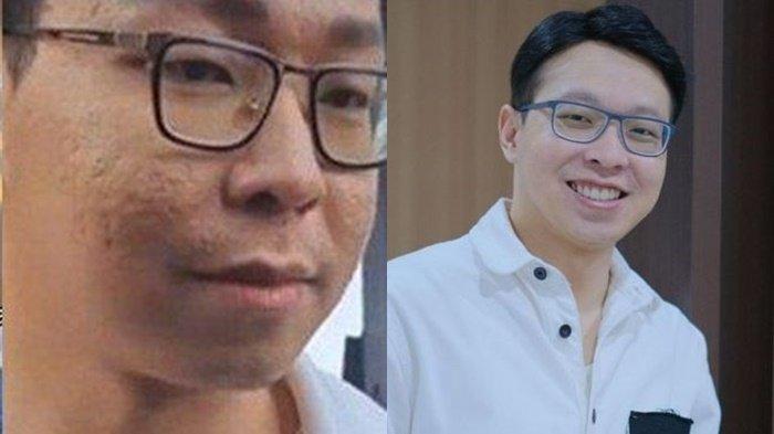Viral Owner Skincare Athena Banyak Bopeng di Wajah, Dokter Richard Lee: Sebenarnya Ga Separah Itu