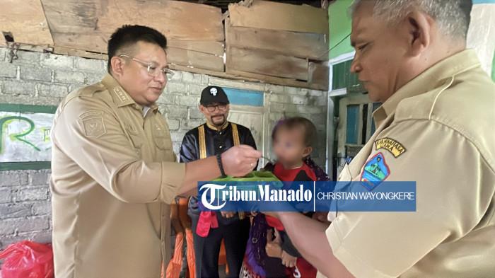 Pemkab Minut Seriusi Masalah Stunting: Wabup Kevin Lotulung Sambangi Anak, Datangkan Orang Tua Asuh
