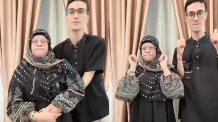 Sosok Yuni Manurung, Wanita Pengidap Sindrom Langka yang Hobi Pamer Foto-foto Mesra dengan Pacarnya