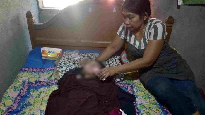Aisyah Terbaring Selama 15 Tahun, Bermula Saat Hadiri Hajatan, Tak Berobat Dokter Hanya ke Dukun