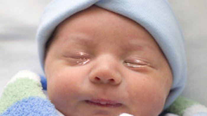 Normalkah Bayi Baru Lahir Sering Belekan?