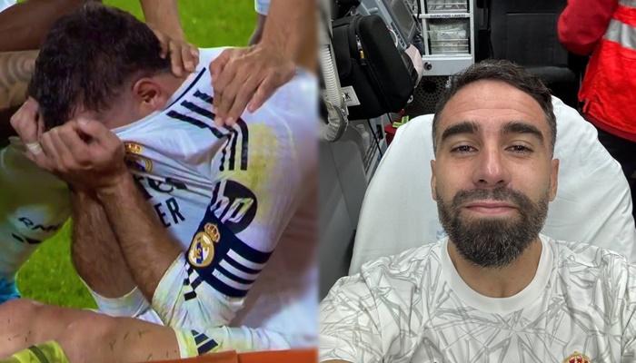 Dani-Carvajal-Alami-Cedera-ACL-Berpotensi-Absen-hingga-Semusim-Real-Madrid-Bersiap-Cari-Pengganti.jpg