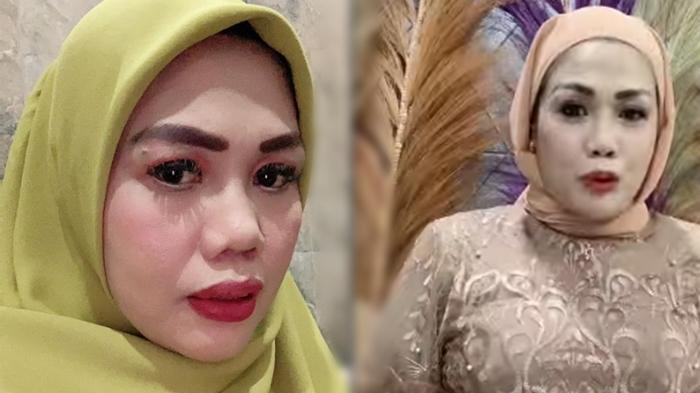 Elly-Sugigi-makin-cantik-setelah-potong-gigi.jpg