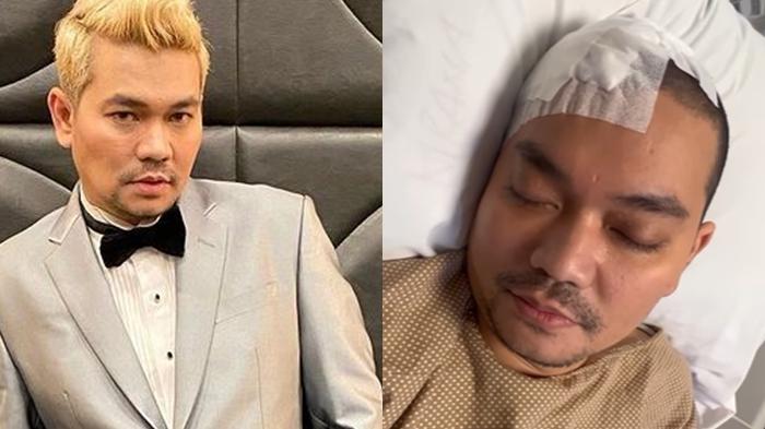 Istri Indra Bekti Minta Doa, Ungkap Kondisi Terkini sang Suami