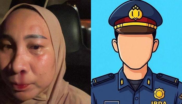 Kolase-foto-ilustrasi-polisi-dan-Endah-Dewi-Lestari-Usman-wanita-yang-dianiaya-oleh-suaminya.jpg