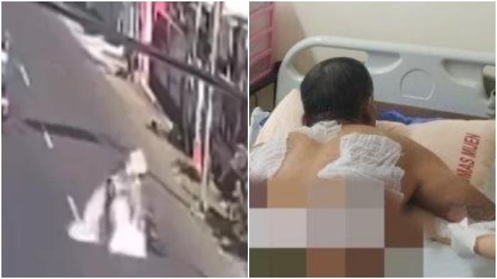 Kondisi-tukang-bakso-tersiram-kuah-panas-dagangannya-hingga-videonya-viral-di-media-sosial.jpg