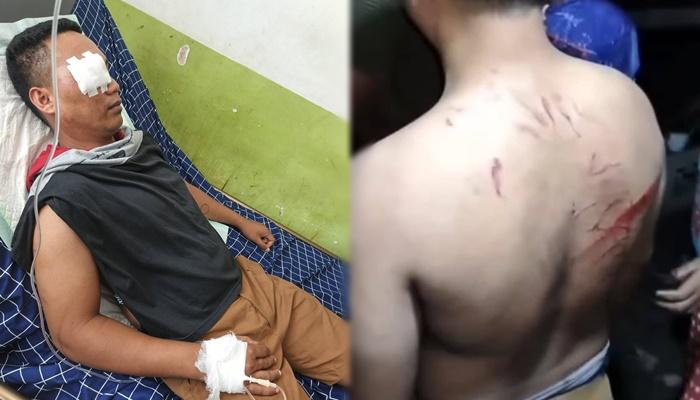 Oknum-Anggota-TNI-AL-Melonguane-Talaud-Diduga-Aniaya-Warga-Korban-Alami-Luka-dan-Dirawat-di-RS.jpg