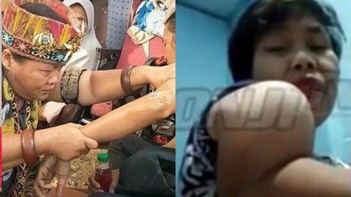 Viral Seorang Wanita Protes Tangannya Tak Kunjung Sembuh, Ida Dayak: Jangan Terlalu Berharap