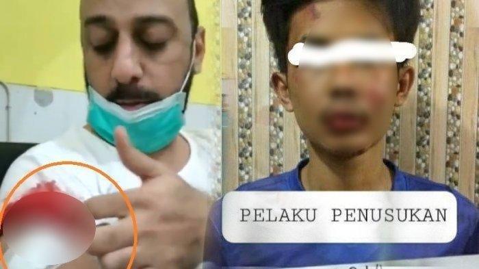 Alpin Andrian Tak Terbukti Lakukan Percobaan Pembunuhan Berencana, Divonis Hakim 4 Tahun Penjara