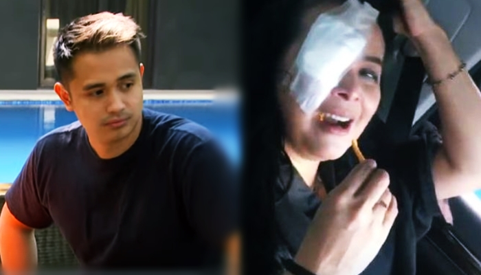 Mata Kanan Jennifer Jill Diperban, Ajun Perwira Singgung Soal KDRT, Ada Apa?