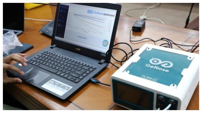 Dinilai Akurat, Ini Harga Alat Pendeteksi Covid-19 GeNose Yang Menggunakan Teknologi AI