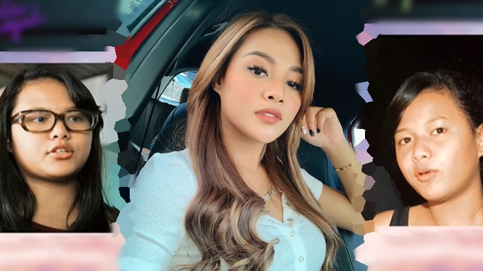 Dituding Lakukan Operasi Plastik, Aurel Hermansyah Beberkan Transformasi Bentuk Tubuh dan Wajahnya