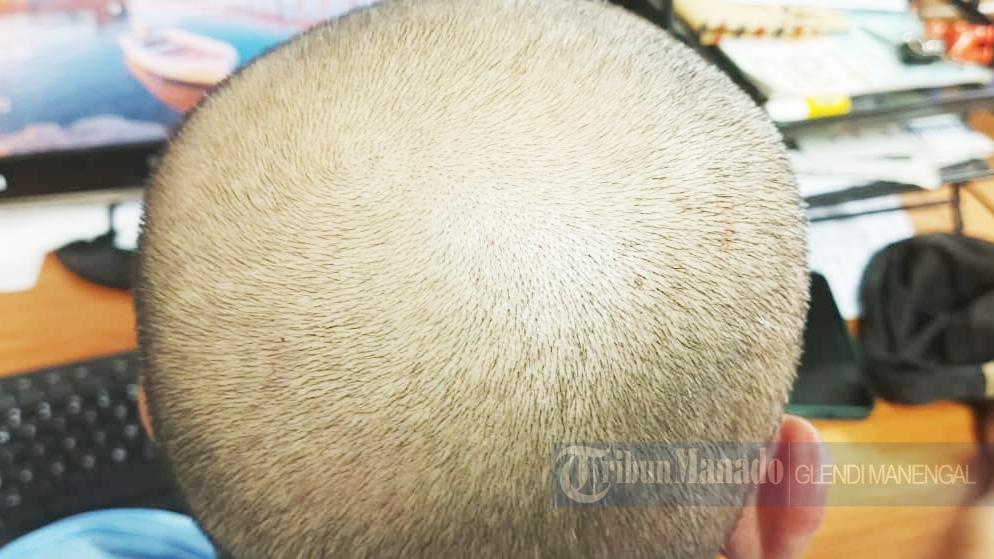 bahan-minyak-alami-untuk-mengatasi-penipisan-rambut-atau-kebotakan.jpg
