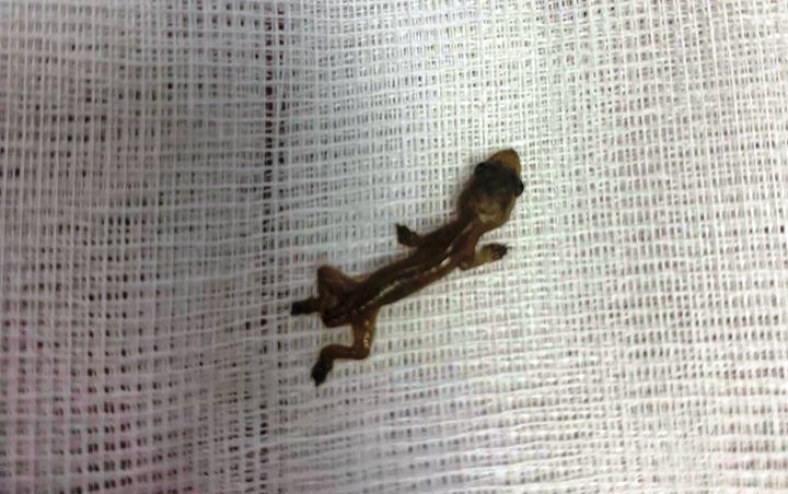 Hari Pertama Bertugas, Dokter Muda Ini Dapati Cicak Hidup di Lubang Telinga Pasien