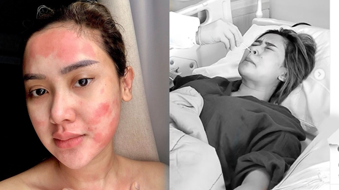 Cita Citata Sempat Menyerah dengan Penyakitnya, Suhu Tubuh Capai 39 Derajat & Harus Dioperasi