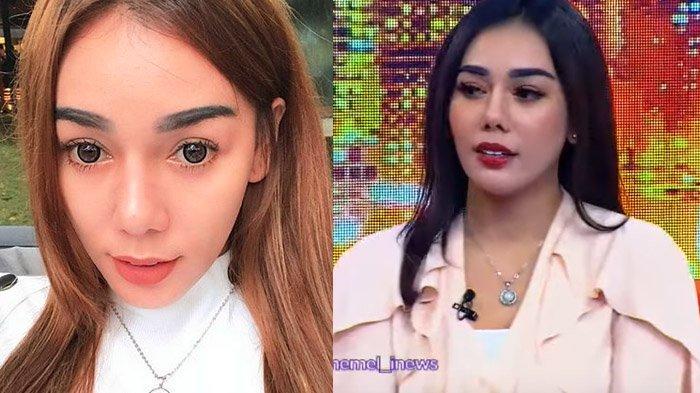 Bebby Fey Blak-blakan Lakukan Operasi Untuk Ubah Bagian Tubuh, Masih Ingin Operasi Lagi?