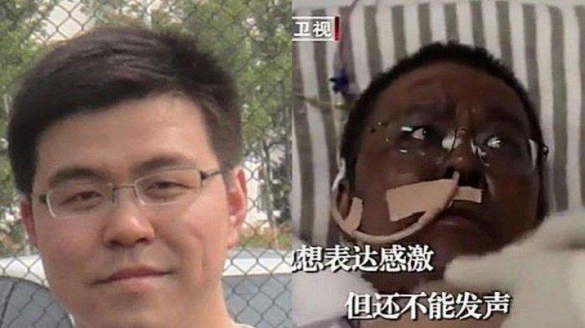 Masih Ingat Dokter Hu Weifeng? Kulitya Menghitam Karena Pengobatan Covid-19, Dikabarkan Meninggal