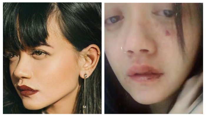 Kabar Duka Inalilahi Wainalilahi Rojiun, Model Cantik Dylan Sada Meninggal, Simpan Kisah yang Kelam