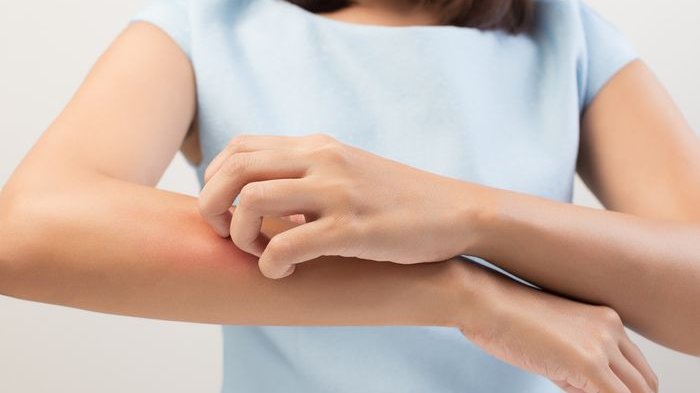 ilustrasi-kulit-gatal-tanda-diabetes.jpg