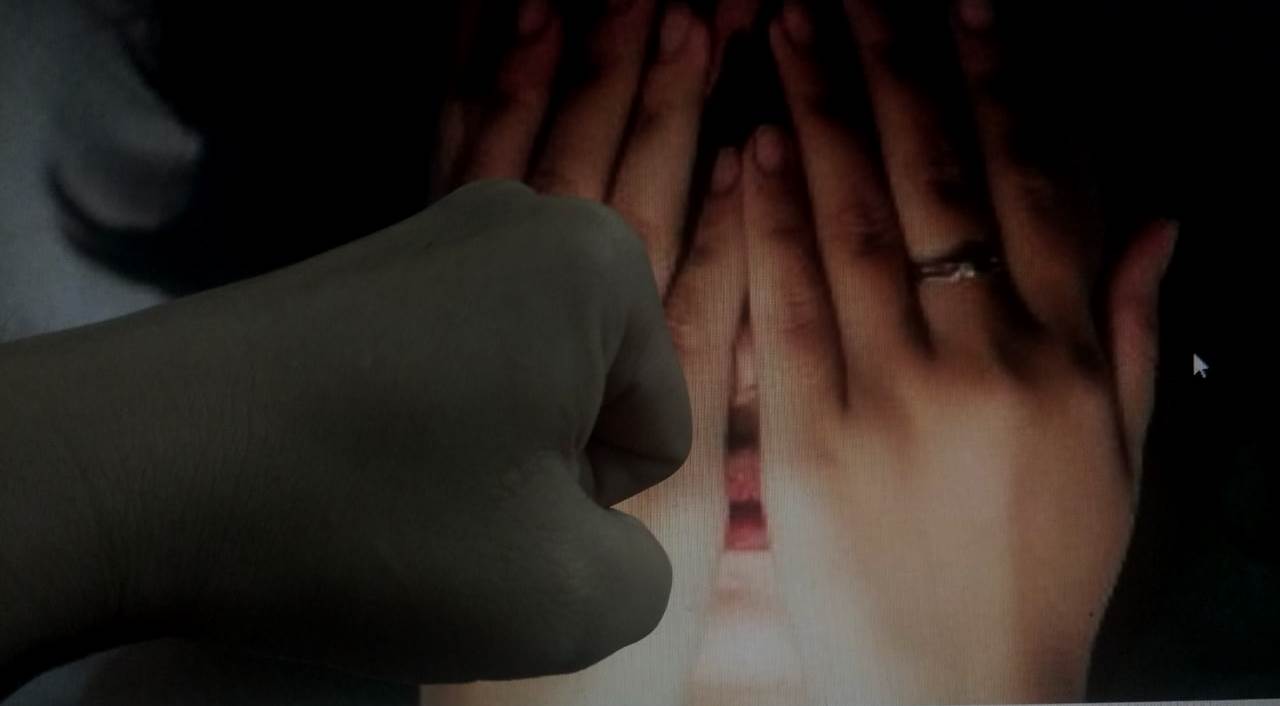 Gara-gara Pinjaman Online Mantan Pramugari Dianiaya Suami, Dipukul dan Ditampar Berulang Kali