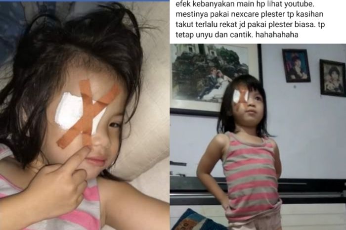 Sering Main Ponsel dan Nonton YouTube, Mata Gadis Cilik Ini Jadi Begini, Peringatan Bagi Orangtua