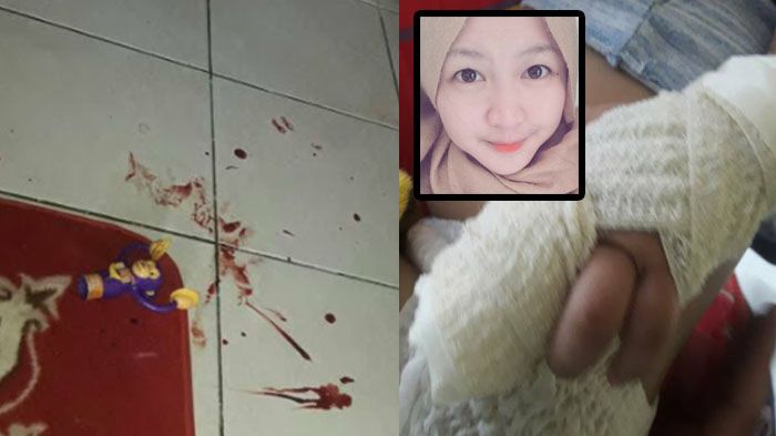 Astaga! Anak Ini Ditinggal Ibunya Sampai Jarinya Putus