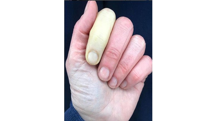 Begini Cara Membaca Karakter Seseorang Dari Bentuk Jarinya