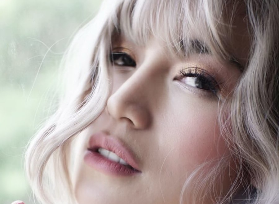 Wajah Jessica Iskandar Penuh Bercak Merah Karena Alergi, Richard Kyle: Dont Worry Love