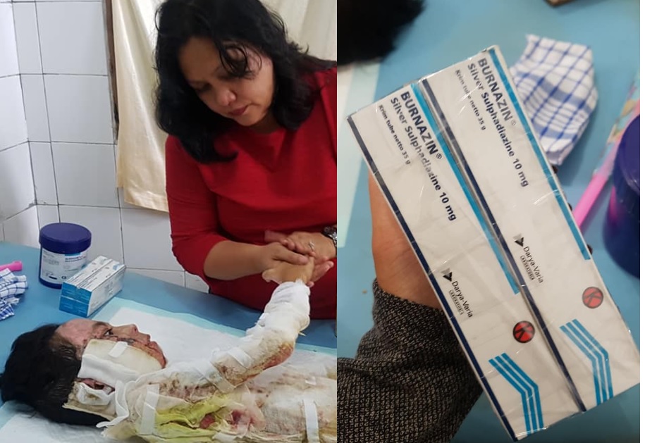 Bocah 9 Tahun Dibakar Ibunya di Sangihe, Jull Takaliuang: Eci Butuh Bantuan