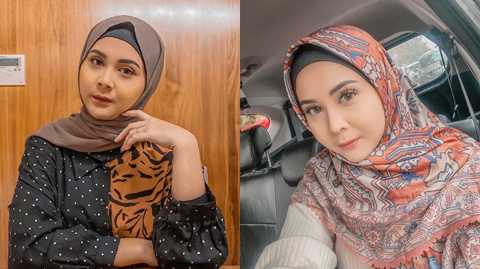 Kesha Ratuliu Geram Disebut Jual Mobil untuk Biaya Nikah: 'Mulut Netizen Emang Minta Dijahit Ya!'