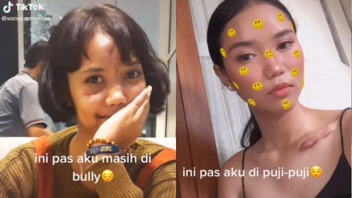 kisah-gadis-dibully-setelah-mengalami-kecelakaan-dfgf.jpg