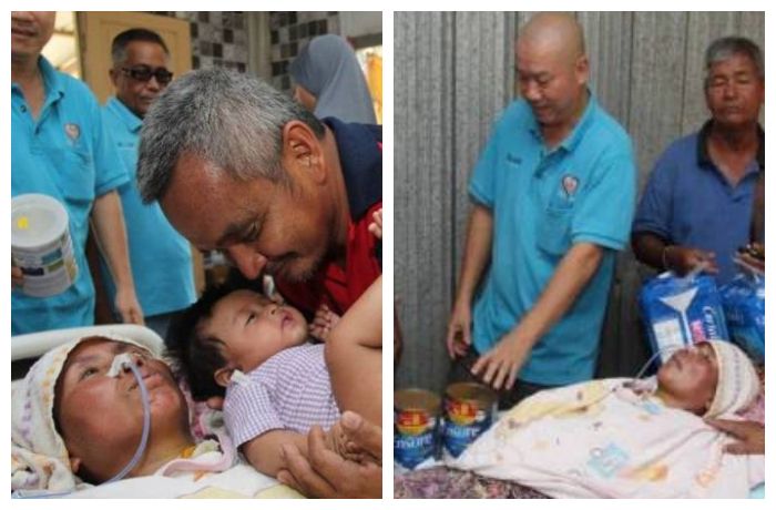 Kisah Wanita yang Lumpuh Total Usai Melahirkan Anak ke-7, Terbaring Kaku dan Menangis Saat Menyusui